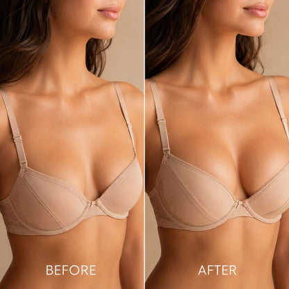 Breast Enhance Mentmicroneedle Patch